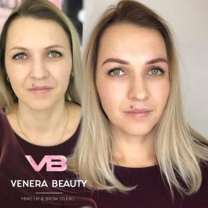 Фотография Venera Beauty 3